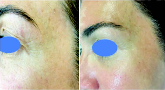 antiaging prima dopo